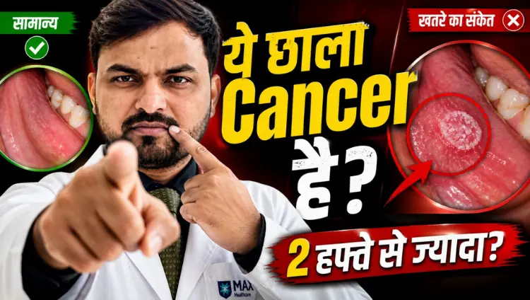Promotional health-awareness thumbnail featuring Dr. Shashank Chaudhary in a white coat at Max Hospital, pointing toward the viewer and touching his cheek. The image compares a healthy tongue on the left with a suspicious tongue lesion circled in red on the right. Bold Hindi text warns that a mouth sore lasting more than two weeks could be oral cancer symptoms.